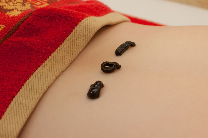 下背部水蛭与骨软骨病